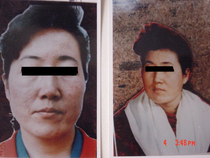 中州藥膏使用前后對比5